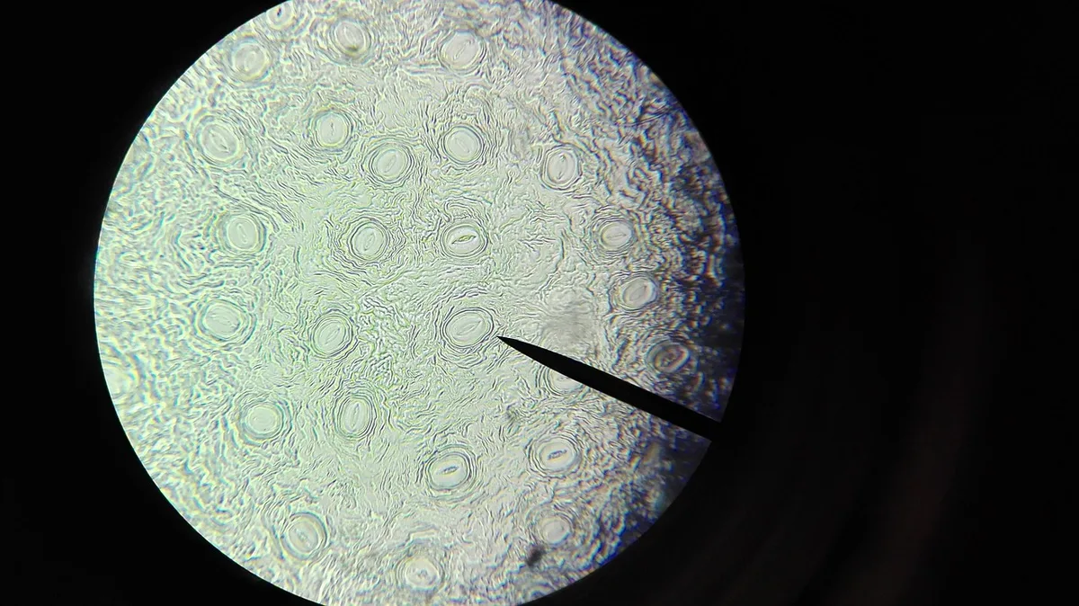 Mikroskopische Aufnahme der Naegleria fowleri Am&ouml;be unter dem Mikroskop